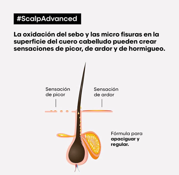 L’Oreal Scalp Advanced Champú Anti Malestar Cuero Cabelludo Sensible 500ml