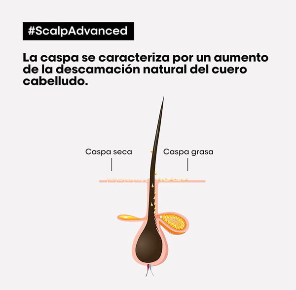 L’Oreal Scalp Advanced Champú Anticaspa 500ml